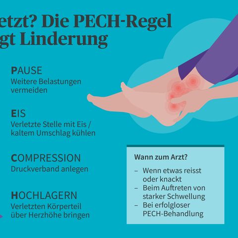 Grafik zur PECH-Regel bei Verletzungen: Pause, Eis, Compression, Hochlagern; zusätzlich Hinweise, wann man zum Arzt gehen sollte.